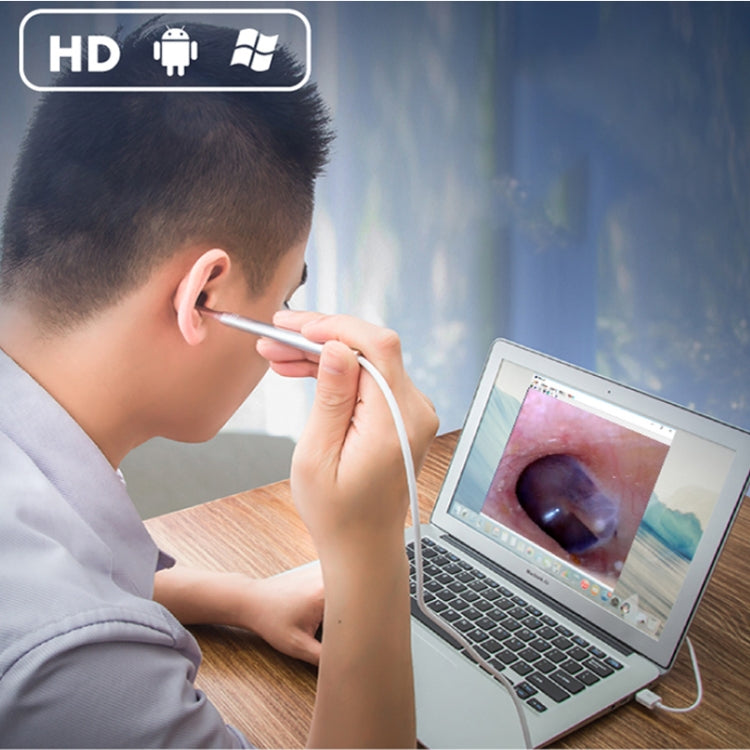 กล้องส่องหู จมูก ฟัน ความละเอียด 1MP HD พร้อมไฟ LED 6 ดวง ขนาดเลนส์: 4.3 มม.