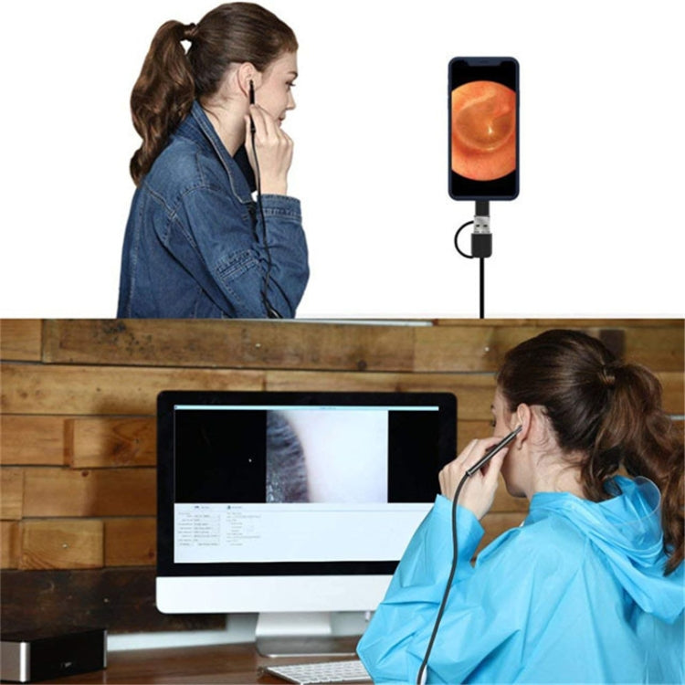 3 in 1 USB HD กล้องส่องตรวจดิจิทัลแบบหู กล้องส่องตรวจดิจิทัลแบบปลายสายสำหรับขี้หู