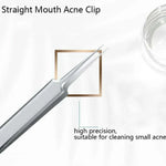 5pcs /Set Acne Needle Stainless Steel Acne Clamp Squeeze Acne Blackhead Tool, 5 in 1