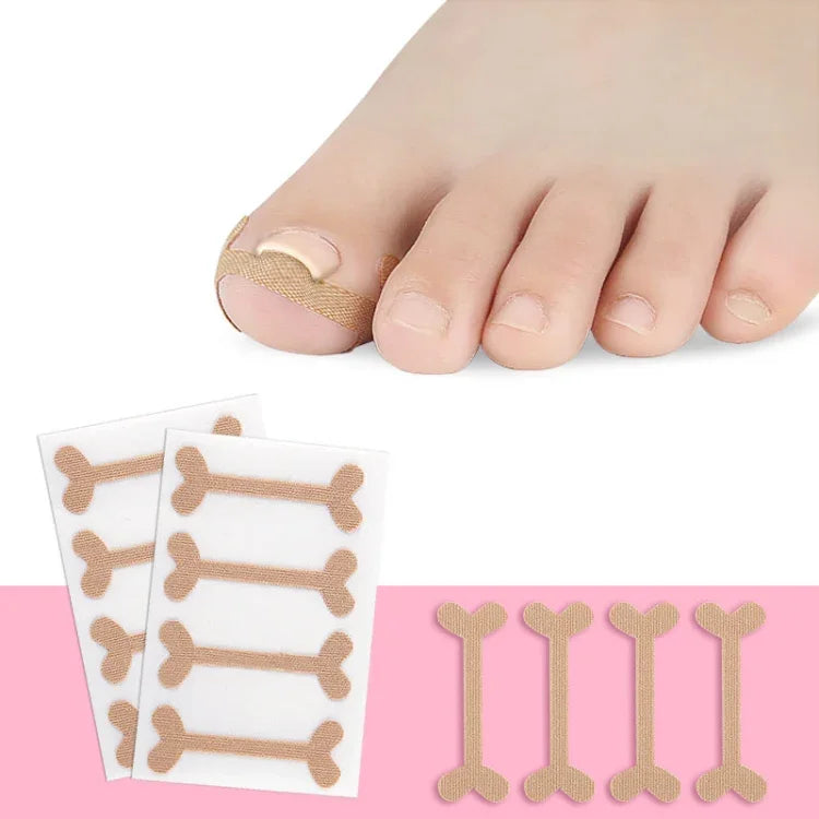 10 Sets Rolled Nail Correction Tape Toe Nail Groove Tape
