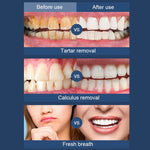 เครื่องขูดหินปูนไฟฟ้าอัลตราโซนิกสำหรับใช้ที่บ้าน เครื่องทำความสะอาดฟันแบบพกพา